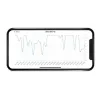 Milian légzésfigyelõ PRO Bluetooth Standard 2db érzékelõlappal