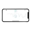 Milian légzésfigyelõ Lite Bluetooth 2db érzékelõlappal